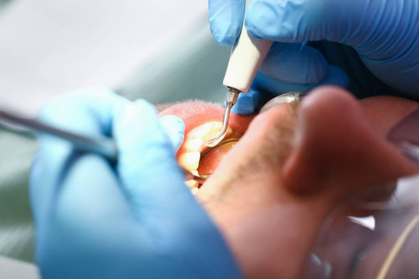 Best Urgent Dental Care for Toothaches in Alamae, NC